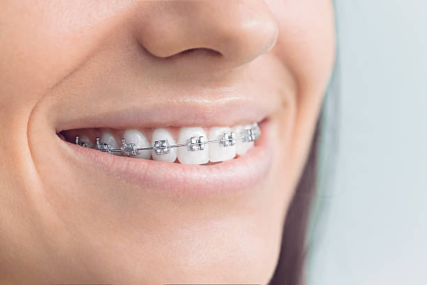 Best Veneers and Lumineers  in Meridian Village, CO